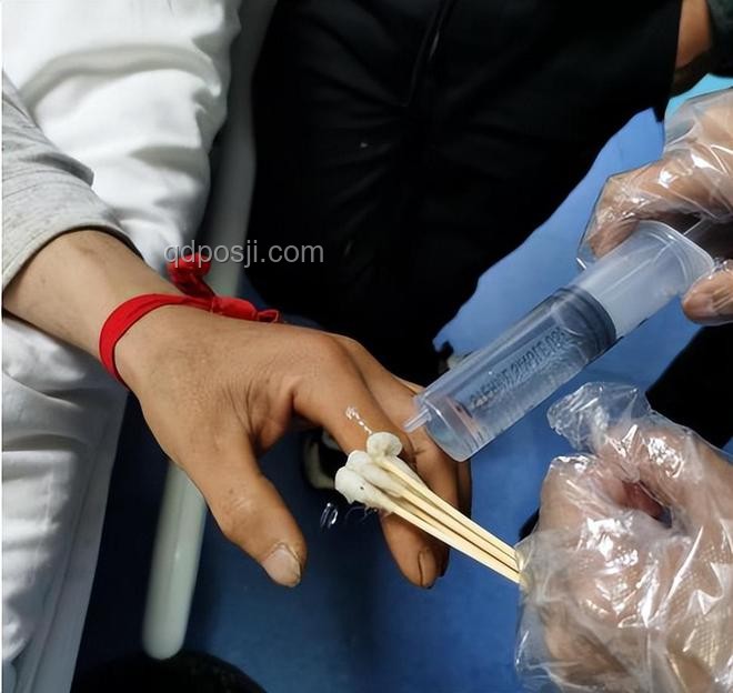 被蛇咬后应急处理指南